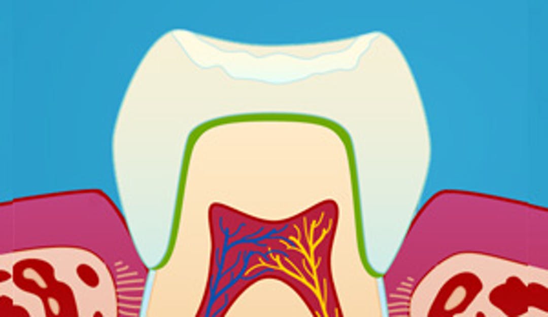 Estetisk kroneterapi